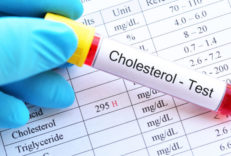 Blood,Sample,Tube,With,Abnormal,High,Cholesterol,Test,Result Blood sample tube with abnormal high cholesterol test result
