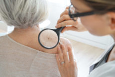 Senior,Woman,Getting,Skin,Checked,By,Dermatologist Senior woman getting skin checked by dermatologist
