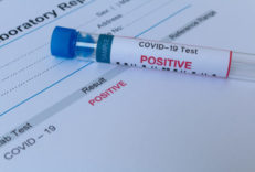 Positive test Coronavirus or COVID-19 concept. Diagnostic testing for COVID-19. Nasal swab laboratory test in hospital lab. PCR DNA testing concept. Medical equipment. Blood test background